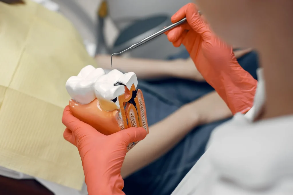 What Does a Root Canal Look Like