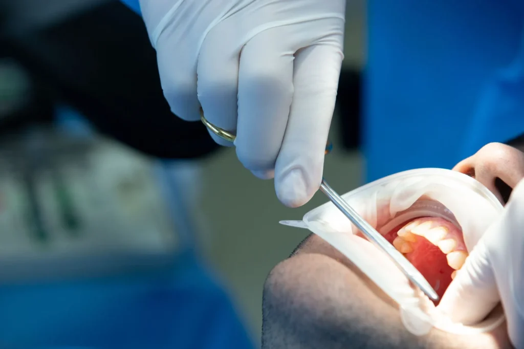 is a root canal painful