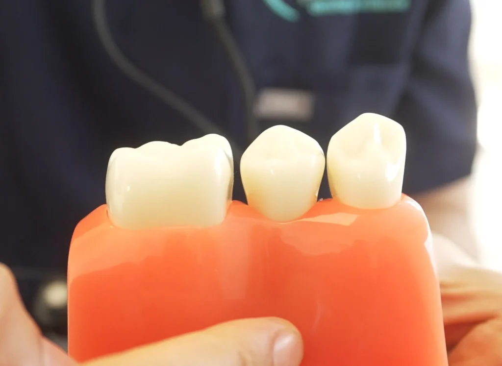 how does a root canal work